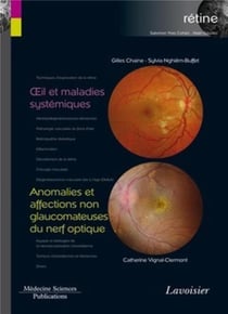 Oeil et maladies systémiques - anomalies et affections non glaucomateuses du nerf optique