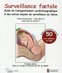 Surveillance foetale - guide de l'enregistrement cardiotocographique & autres moyens de surveillance du foetus