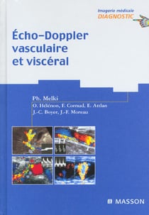 Echo-doppler vasculaire et visceral