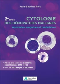 Cytologie des hémopathies malignes : Anomalies sanguines et médullaires (2e édition)