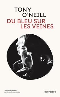 Du bleu sur les veines
