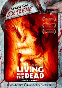The living and the dead