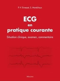 ECG en pratique courante - situation clinique, interprétation, décision