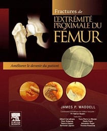 Fractures de l'extrémité proximale du fémur - améliorer le devenir du patient