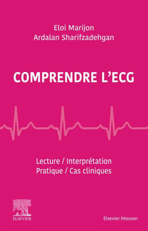 Comprendre l'ECG - lecture, interprétation, pratique, cas cliniques