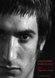 Bande de cons ! la gueule cassée