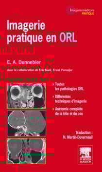 Imagerie pratique en ORL