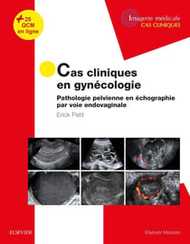 Cas cliniques en gynécologie