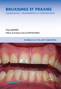 Bruxismes et praxies - diagnostic, traitements et prévention