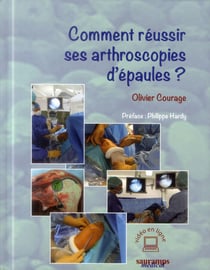 Comment réussir ses arthroscopies d'épaule?