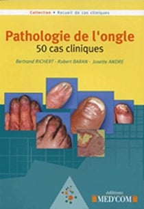 Pathologie de l'ongle - 50 cas cliniques