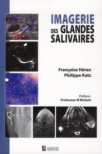 Imagerie des glandes salivaires