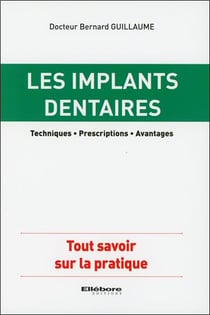Les implants dentaires - techniques, prescriptions, avantages