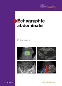 Échographie abdominale