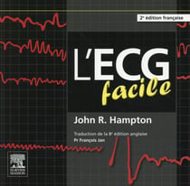 L'ecg facile (2e édition)