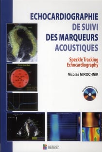 Échocardiographie de suivi des marqueurs acoustiques - speckle tracking echocardiography
