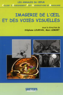 Imagerie De L'Oeil Et Des Voies Visuelles
