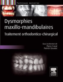 Dysmorphies maxillo-mandibulaires