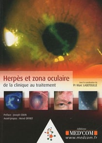 Herpès et zona oculaire - de la clinique au traitement
