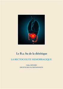 Le b.a.-ba de la diététique - la rectocolite hemorragique