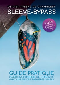 Sleeve - Bypass : Guide pratique pour la chirurgie de l'obésité : Parcours pré-opératoire et premières années