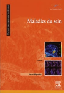 Maladies du sein (2e édition)