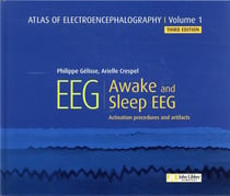 Atlas of electroencephalography v.1 - awake and sleep EEG (3e édition)