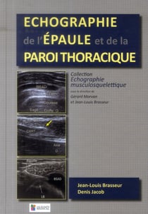 Echographie de l'epaule et de la paroi thoracique