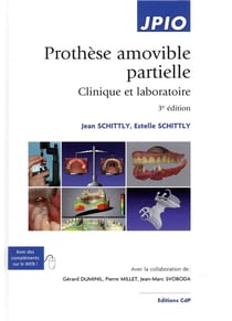 Prothèse amovible partielle (3e édition)