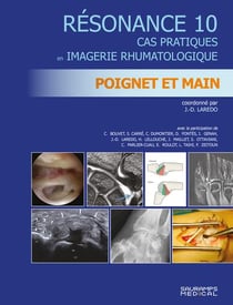 Résonance Tome 10 : Poignet et main