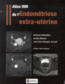 Atlas IRM de l'endométriose extra-utérine