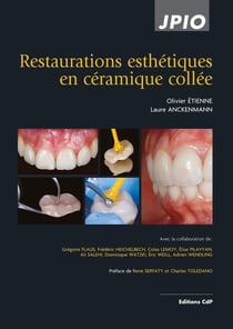 Restaurations esthétiques en céramique collée (2e édition)