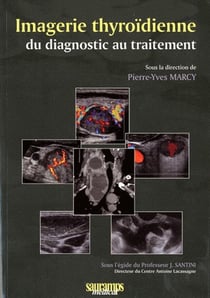 Imagerie thyroïdienne - du diagnostic au traitement