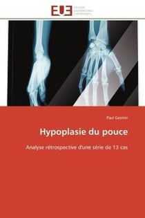Hypoplasie du pouce - analyse retrospective d'une serie de 13 cas