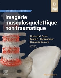Imagerie musculosquelettique non traumatique