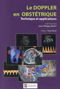 Le doppler en obstétrique - technique et applications