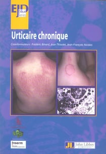 Urticaire chronique
