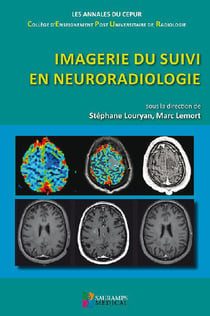 Imagerie du suivi en neuroradiologie