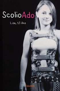 Scolioado : Lise, 15 ans