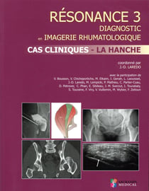 Résonance diagnostic en imagerie rhumatologique Tome 3 : cas clinique - la hanche