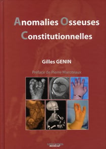 Anomalies osseuses constiutionnelles