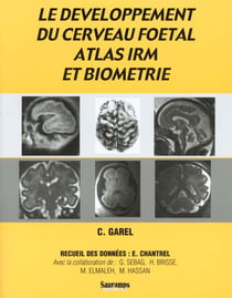 Le développement du cerveau foetal, atlas IRM et biometrie