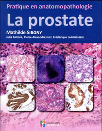 Pratique en anatomopathologie : la prostate
