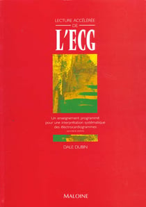 Lecture acceleree de l'ecg