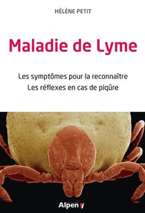 Maladie de lyme - les symptômes pour la reconnaître, les réflexes en cas de piqûre