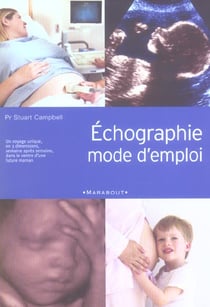 Echographie mode d'emploi