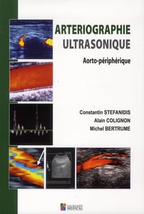 Arteriographie ultrasonique - aorto-périphérique