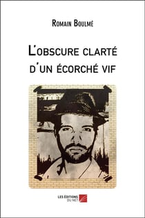 L'obscure clarté d'un écorché vif