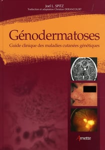 Génodermatoses - guide clinique des maladies cutanées génétiques