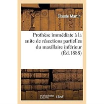 Prothèse immédiate à la suite de résections partielles du maxillaire inférieur